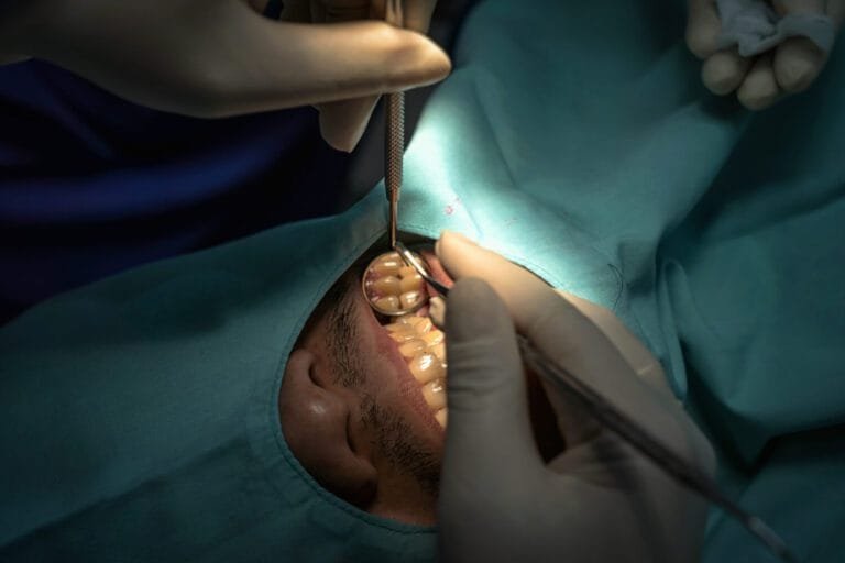 Inflamação Após Extração De Dente: Cuidados Essenciais